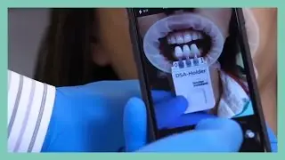 Digital Shade Assistant 