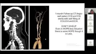 Nightmares in Cathlab by Dr Sridhar Kasturi | Sunshine Hospitals