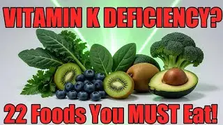 22 Vitamin K Foods to Boost Your Levels | Superfoods for Strong Bones & Health | Easy Wellness