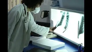 CDC in Action: Global Tuberculosis