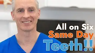 Same Day Teeth