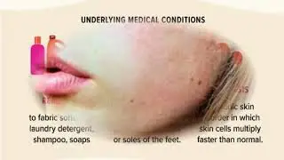 How to Get Rid of Hand Skin Peeling Stop Dry Skin -5 Tips to Get Rid of Peeling Skin from Fingertips