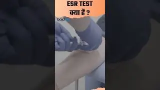 ESR Blood Test Kya Hai #esr #esrtest #bloodtest #healthtips #healthylifestyle #blood