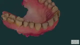 High-Precision 3D Dental Scanning: Digital Jaw & Teeth Modeling by Aestar Company