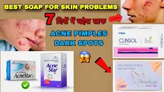 Best Soap For Skin Problems | Pimples Acne Dark Spots | Acnestar Clinsol Skinshine Soap