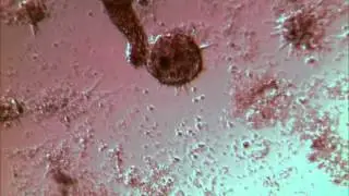 B.glabrata hemocytes attack S.mansoni