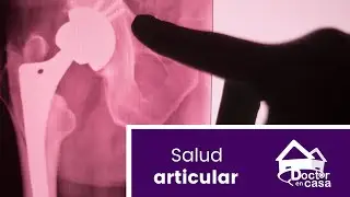 Salud articular