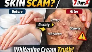 Gora Hone Ka Dhokha &mdash; Whitening Cream Scam Explained