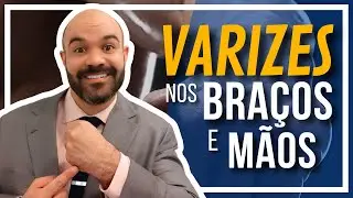 🔴 Varizes das M&Atilde;OS e BRA&Ccedil;OS!! Existe isso? #vidasemvarizes