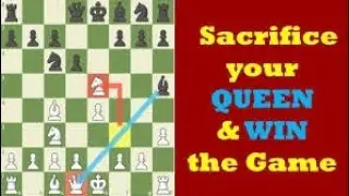 🎬Sacrificing figures for fun Rating(1835) #chess #chesscom #chessgame #chessplayer #chesstactics