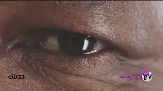 Johnson & Johnson Vision talks cataracts