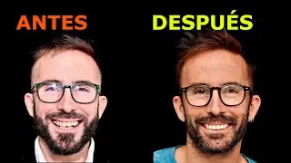 ¡Transforma tu sonrisa!