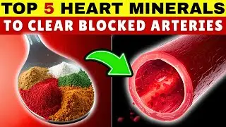 Top 5 Minerals Your Heart Needs to Unclog Arteries