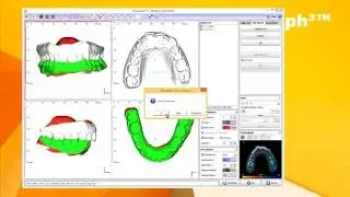 OnyxCeph³™ Modules Add Image / Adjust / Segmentation / Digitize 3D