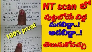 NT scan gender predicted baby boy or girl with heart rate and CRL in Telugu.