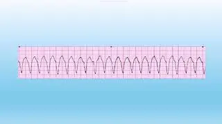 Let's Learn EKG