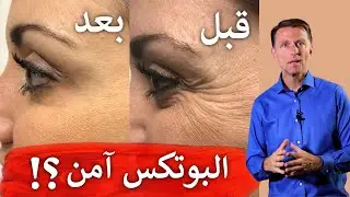 رأي الدكتور بيرج بالبوتكس | ماهو وهل هو آمن؟!