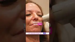 Top Cosmetic Treatments in Your 50's | Skin Tightening NYC