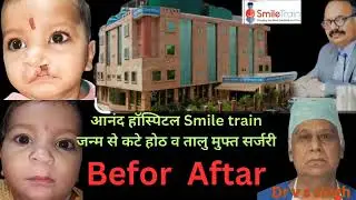 #viralvideo #birthdefect #cleftlip&palate #cutebaby #shortsvideo#shortsreels #youtubeshorts#trending
