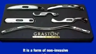 IASTM TOOLS