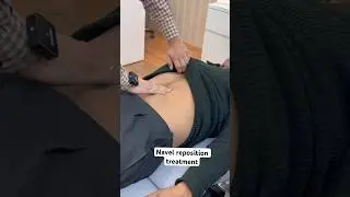 Navel reposition treatment | navel displacement treatment #trending  #shortsfeed  #feed