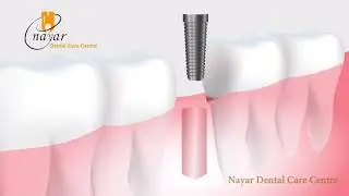 Best Dental Clinic in Noida   | Nayar Dental Care Centre