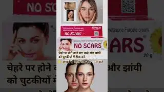 No Scars day Cream Review #noscars #youtubeshorts #skinshinecream #clearskin