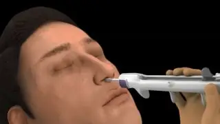 Баллонная синусопластика - Willis Knighton Health