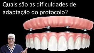 Como é a adaptação do protocolo (dentadura fixa) | Dra Bianca Rosa | Master Pride Odontologia