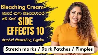 Bleaching Creams ගෑවොත් වෙන ප්&zwj;රතිවිපාක / 10 SIDE EFFECTS OF BLEACHING CREAMS 