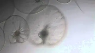 Noctiluca scintillans