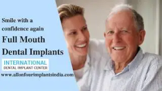 Full Mouth Dental Implants In Chennai | Full Mouth Restoration Surgery in Tamil nadu, India