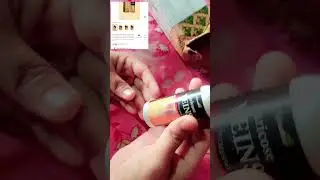 Good for varicose veins healthy care spray#comment for link 🖇️