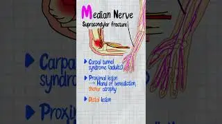 USMLE Step 1 Mnemonic for Brachial Plexus Nerve Injuries | ARM-U Explained in 60s