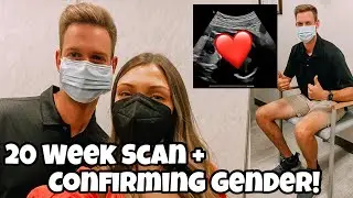 20 Week Anatomy Scan + Confirming Gender of Baby! | Boy or Girl??