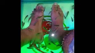 Doctor Fish, #doctorfish