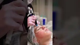 Facial treatment #london #londonaestheticsrejuvenation