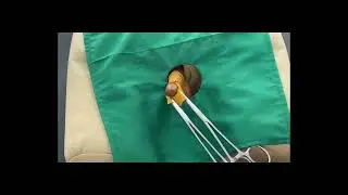 Video Student Project B9-Sirkumsisi
