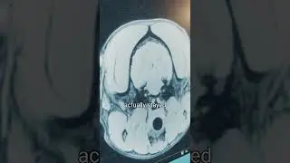 MRI services that won't leave you hanging