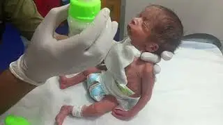 Premature Baby Feeding: Complete Guide to Nutrition, Schedule & Care