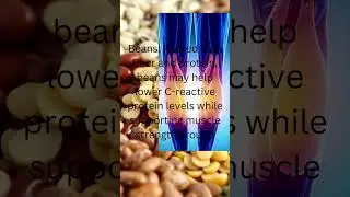 Foods Other Than Dry Fruits to Fight Arthritis Inflammation