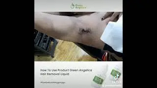 cantik amanah perontok bulu da