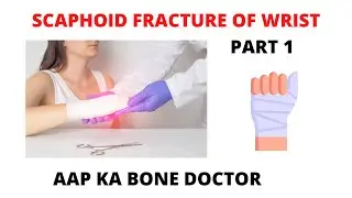 SCAPHOID FRACTURES OF WRIST -PART 1. EPISODE 1