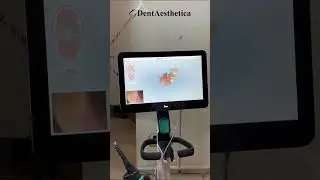 Wanna know how we do it? Book your slot now.#clearaligners  #dentaesthetica #dentalteam