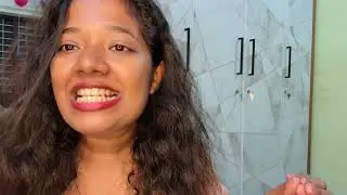  എന്റെ ഒരു മാസത്തെ clear retainer 🦷experience |Malluz express 