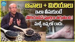 How To Prevent Psoriasis Skin Disease | Psoriasis Food That Helps, | Psoriasis Treatment Telugu