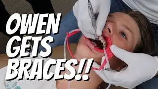 GETTING BRACES FOR THE FIRST TIME| HOW PAINFUL IS GETTING BRACES FOR THE FIRST TIME