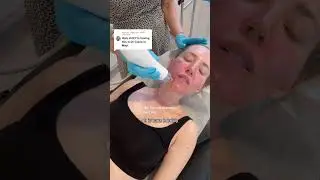 Секретный RF &mdash; это больно? #уходзакожейлечение