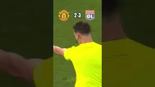 Man Utd vs Lyon🔥