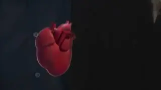 Mitralklappe mit Herzfehler - Anatomie CGI Animation